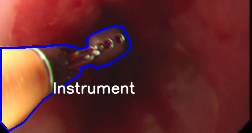 Endoscopy image with overlaid labelling of saturation and instrument