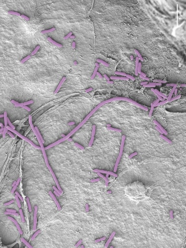Bacteria and Biofilm on Orgaoid Model