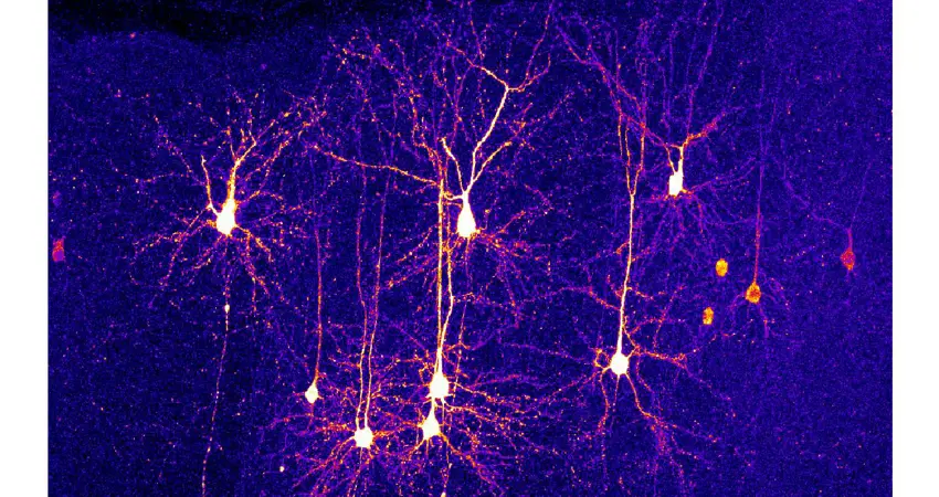 Sparse Gcamp6f Labelling In Motor Cortex