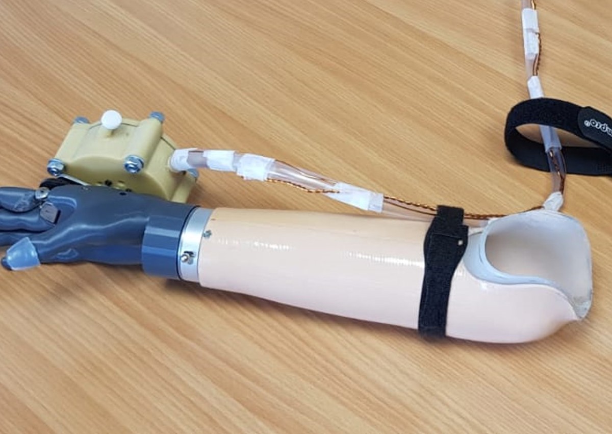 Connected prosthetic hand