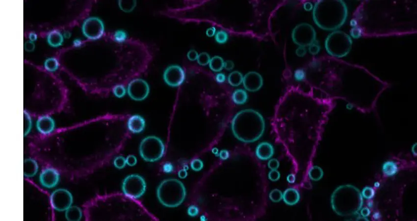 A graphic image of bubbles