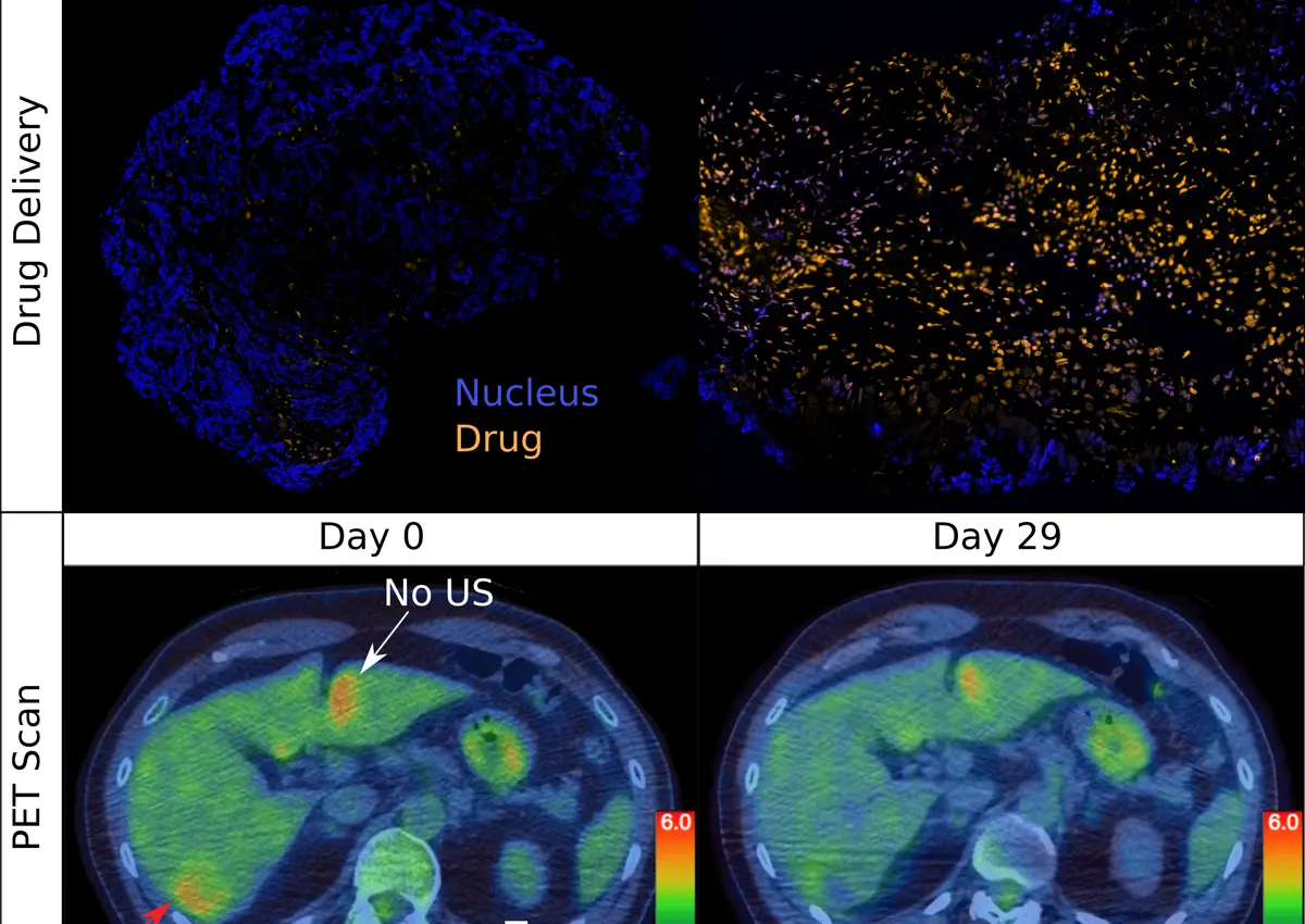 PET Scan showing tumour response before (day 0) and after ultrasound (day 29)