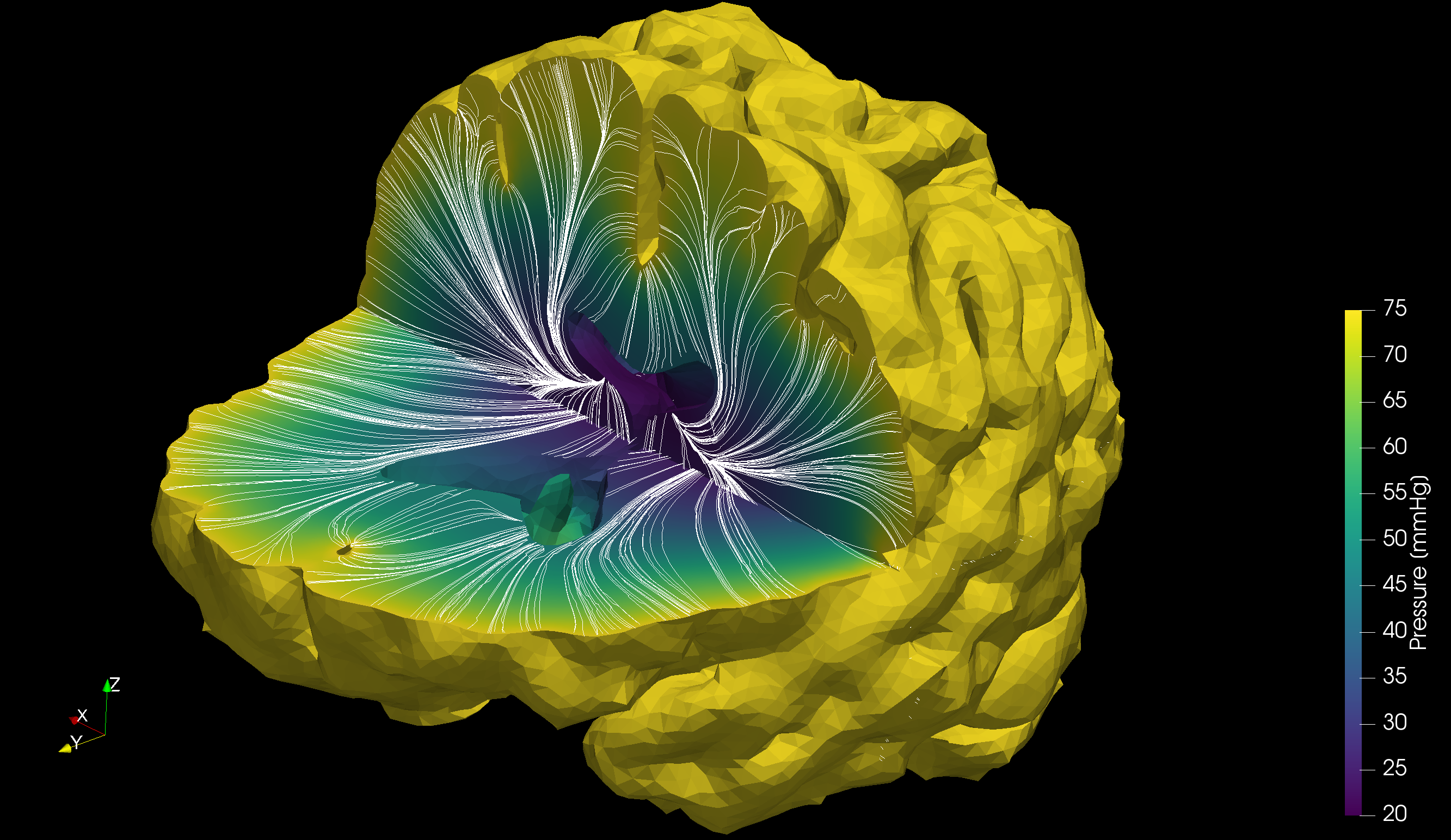 Computer model of brain with cut out section showing capillary velocity streamlines