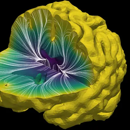 Computer model of brain with cut out section showing capillary velocity streamlines