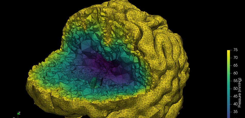 Computer model of brain blood and oxygen transport that are used to run clinical trials on computers