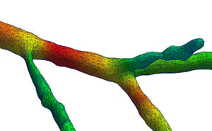 Main image: Numerical model of a neuron under mechanical loading