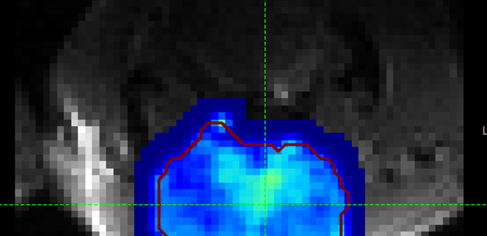 cest_tutorial_smooth_output