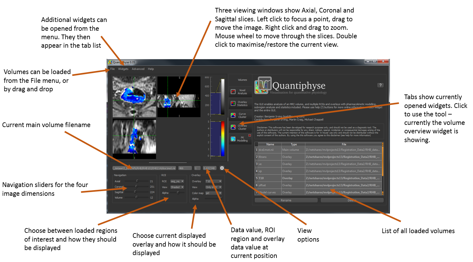 Overview of Quantiphyse features