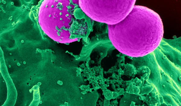 A computer image of some sort of purple cells