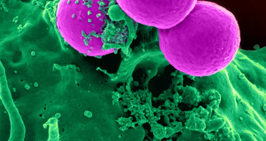 A computer image of some sort of purple cells