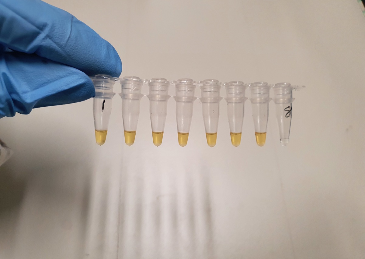 Researcher holding vials containing saliva samples for test which uses a simple colour change to identity presence of the Covid-19 virus. A positive sample changes from pink to yellow