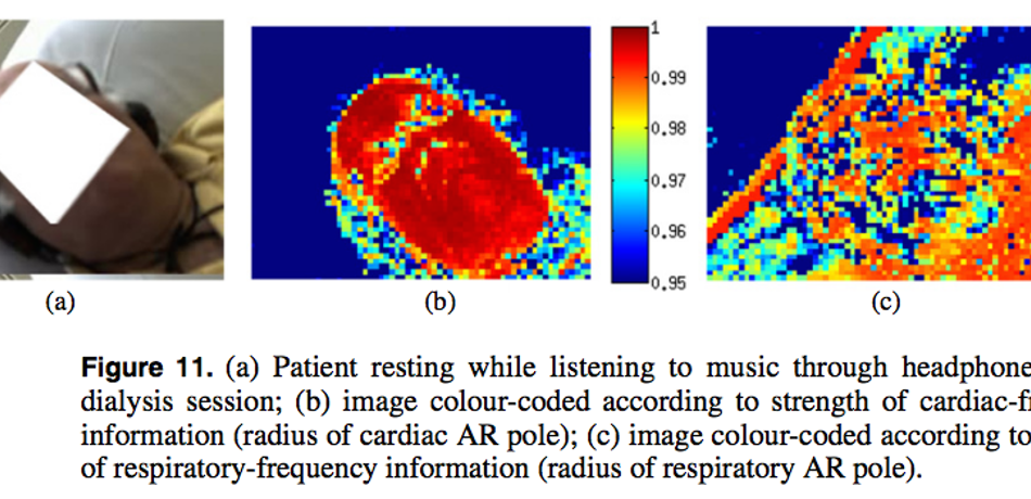 Figure of patient resting while listening to music during dialysis session, image is colour-coded according to strength of cardiax-frequency information and strength of respiratory-frequency information