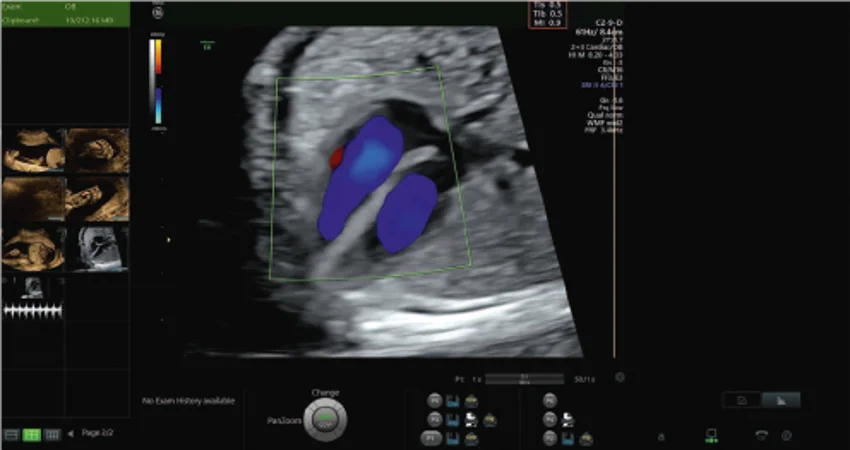 A frame recorded during a routine ultrasound scan. The safety markers are displayed in the top-right of the ultrasound image.