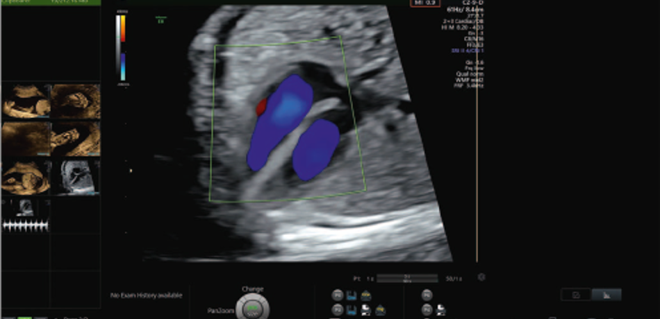 A frame recorded during a routine ultrasound scan. The safety markers are displayed in the top-right of the ultrasound image.