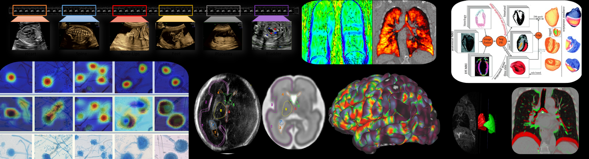 Biomedical Image Analysis