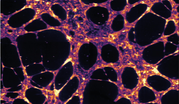 Endothelial networks single cells
