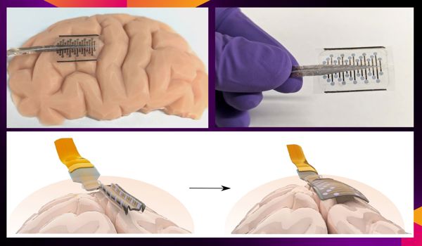 A research team led by the University of Oxford and the University of Cambridge have created new ‘origami-inspired’ brain electrodes that can fold up to a fraction of their full size. 