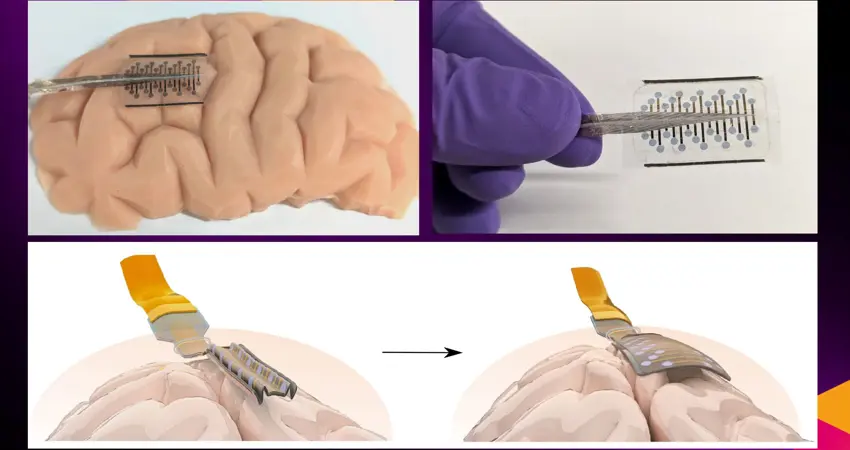 A research team led by the University of Oxford and the University of Cambridge have created new ‘origami-inspired’ brain electrodes that can fold up to a fraction of their full size.