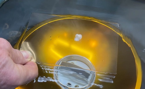 The new HIFU machine at the Churchill Hospital increases the power of ultrasound by a factor of 10,000