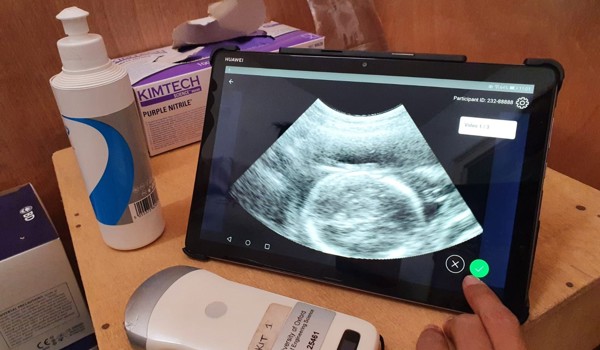 Tracer project - combines low-cost ultrasound equipment with artificial intelligence (deep learning) based image analysis algorithms