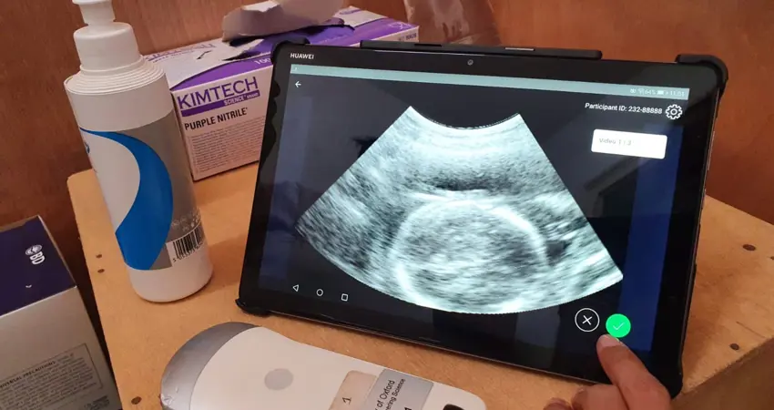 Tracer project - combines low-cost ultrasound equipment with artificial intelligence (deep learning) based image analysis algorithms