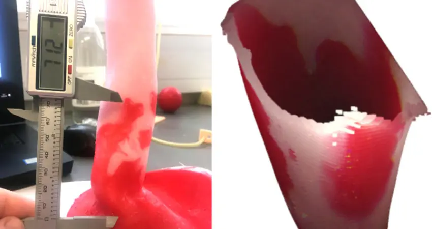 I-driven 3D reconstruction of Barrett’s oesophagus