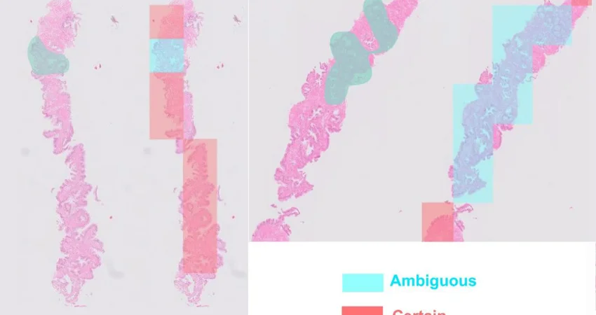 AI Pathology Image