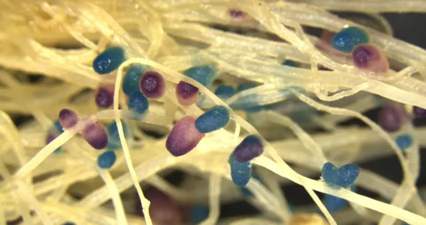 Plant root with stained nodules, courtesy of Raphael Ledermann, Department of Plant Sciences