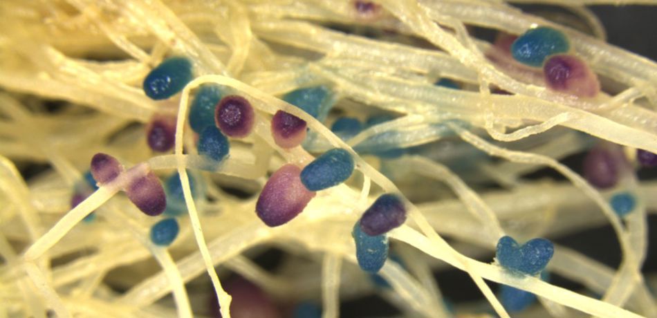 Plant root with stained nodules, courtesy of Raphael Ledermann, Department of Plant Sciences 