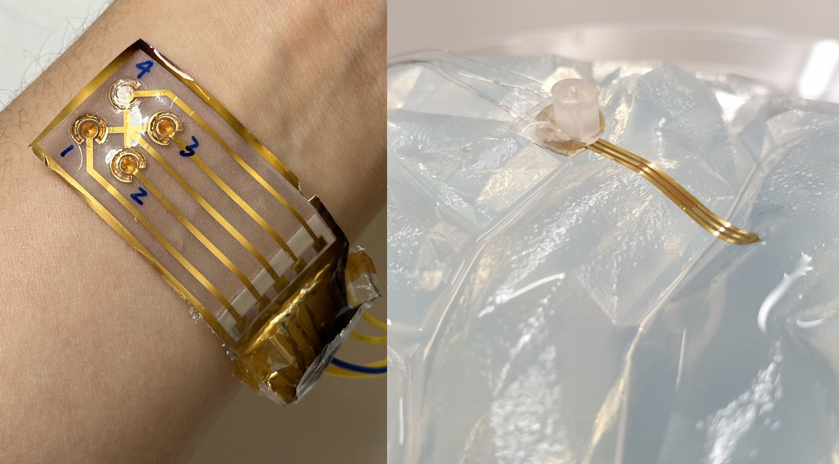 Left: Prototype of a flexible skin patch as a wearable device to control nerve signals. Right: Prototype of a soft, flexible implant that could precisely deliver drugs to specific areas of the brain or nerves. Images courtesy of Yixuan Leng, Massimo Mariello, Oxford Bioelectronics, Christopher Proctor.