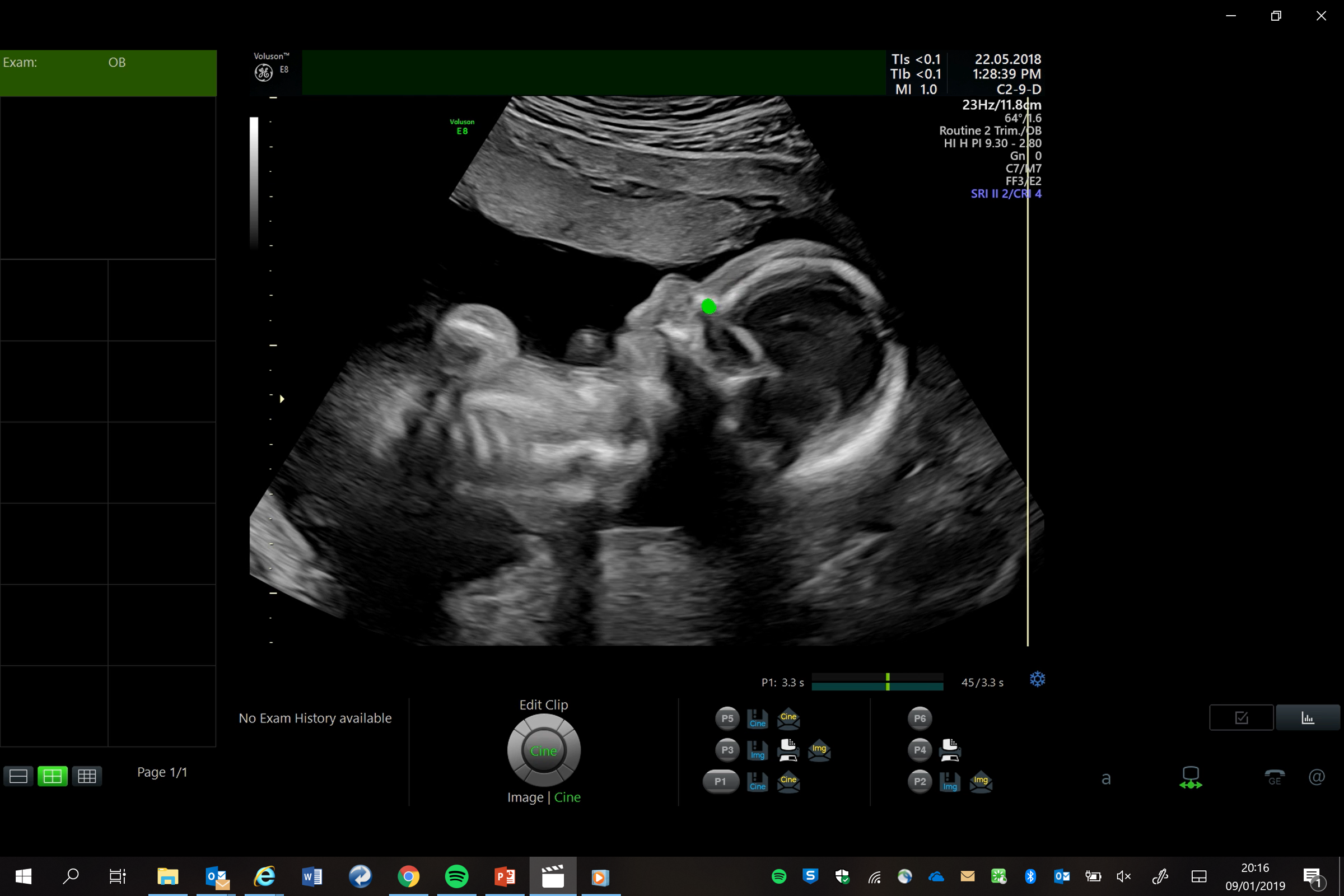 Freeze frame of eye tracking used on sonographer during scan
