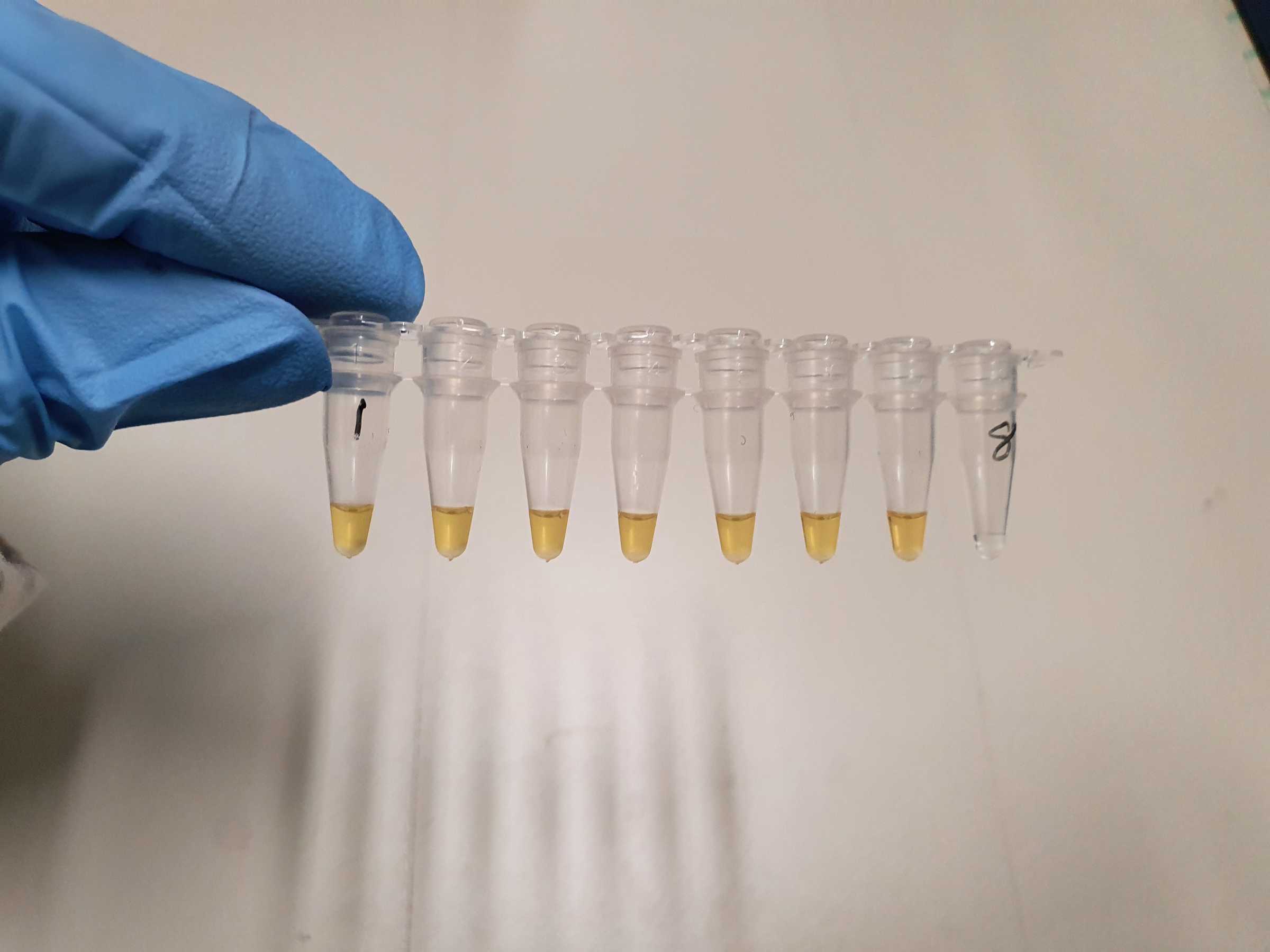 Researcher holding vials containing saliva samples for test which uses a simple colour change to identity presence of the Covid-19 virus. A positive sample changes from pink to yellow