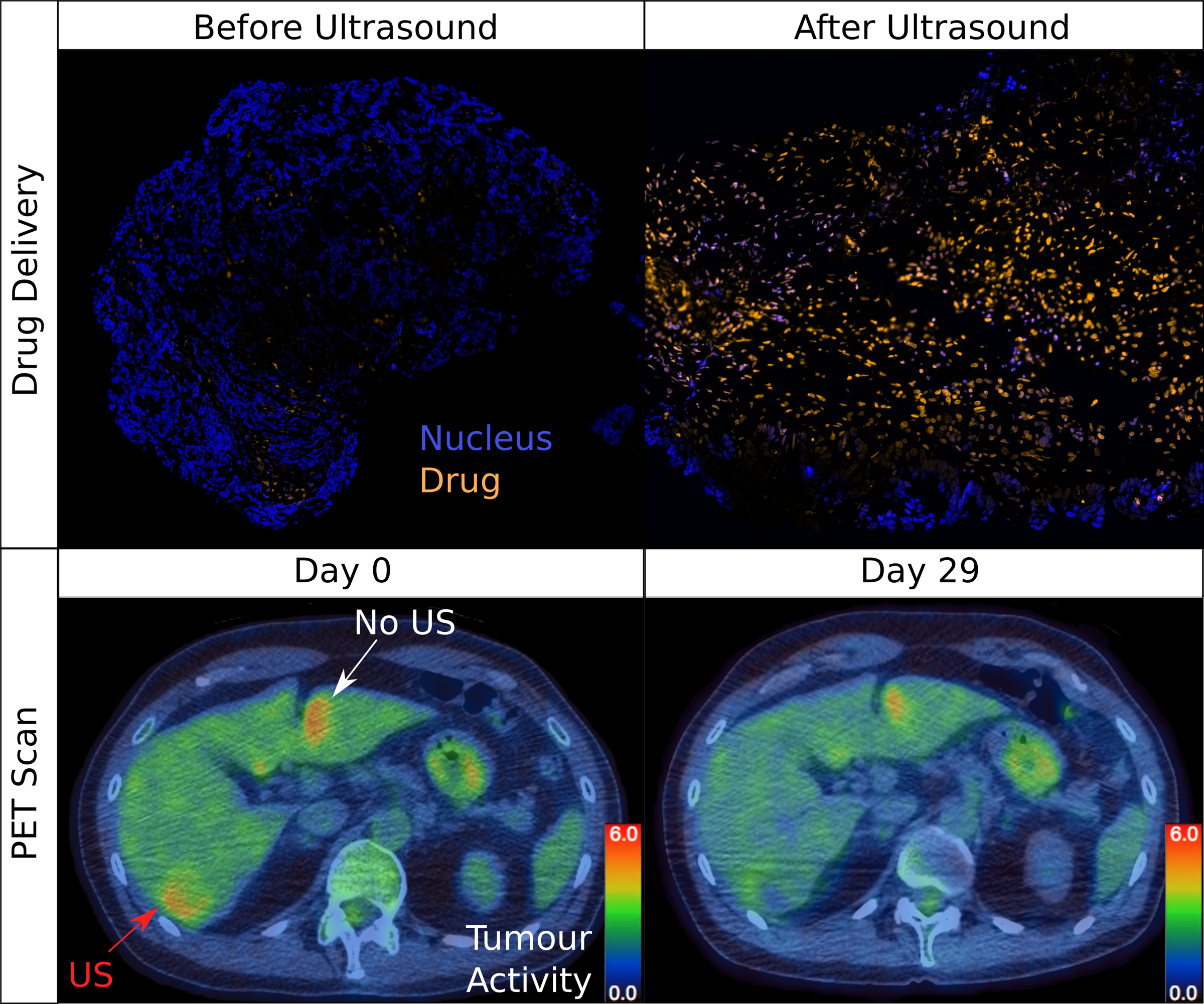 PET Scan showing tumour response before (day 0) and after ultrasound (day 29)