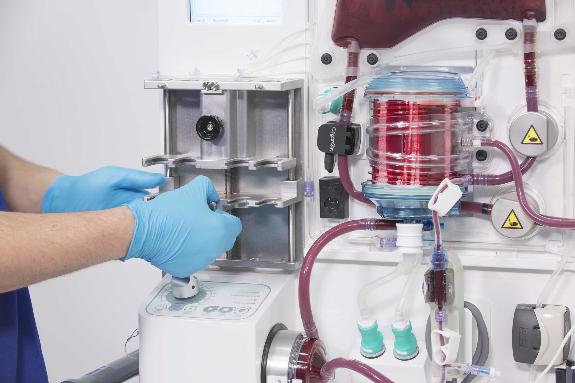 Clinician working on Organox metra machine which enables storage and functional assessment of donor organs prior to transplantation