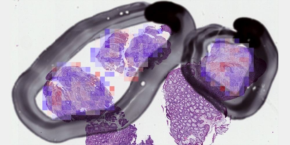 AI-enabled medical imaging has the potential to enable faster, more accurate diagnosis and surveillance