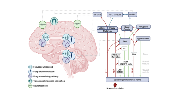 Graphic of brain showing systems engineering approaches to pain including focused ultrasound, deep brain stimulation, drug delivery and transcranial mangnetic stimulation